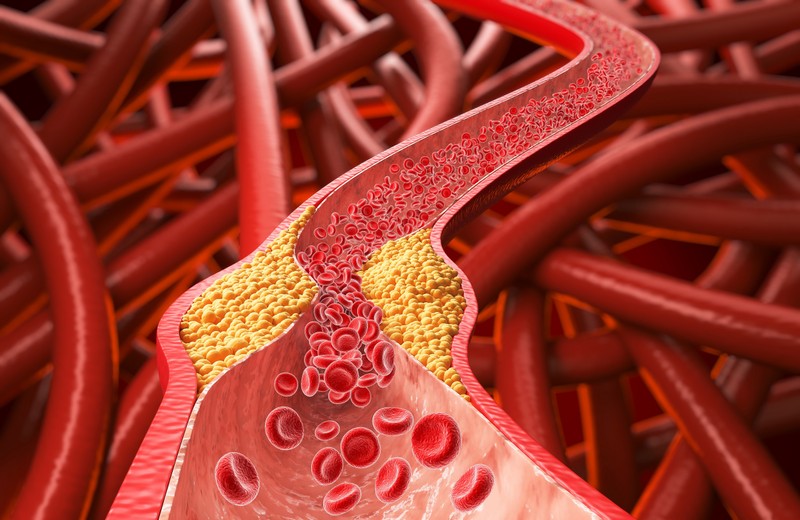 Magas koleszterinszint ellen mit együnk és mit ne? Dietetikus mondja el, mit kerüljön