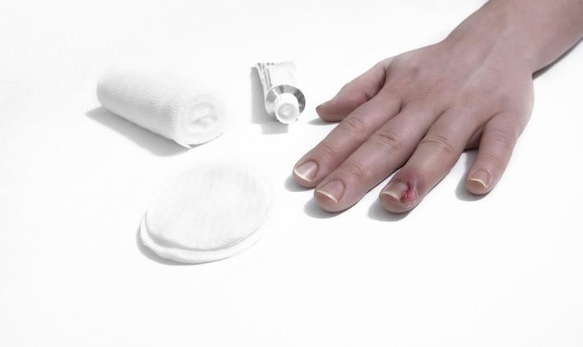 A gyulladásos folyamat kezdetén megkísérelhető gyógyszeres kúra, helyileg alkalmazott krém, gyulladáscsökkentő tabletta.