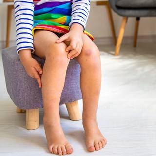 Hideg időben erősödhet a reumatológiai betegségben szenvedő gyerekek fájdalma című cikk nyitóképe