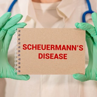 Scheuermann-kór tünetei, vizsgálata és kezelése című cikk nyitóképe