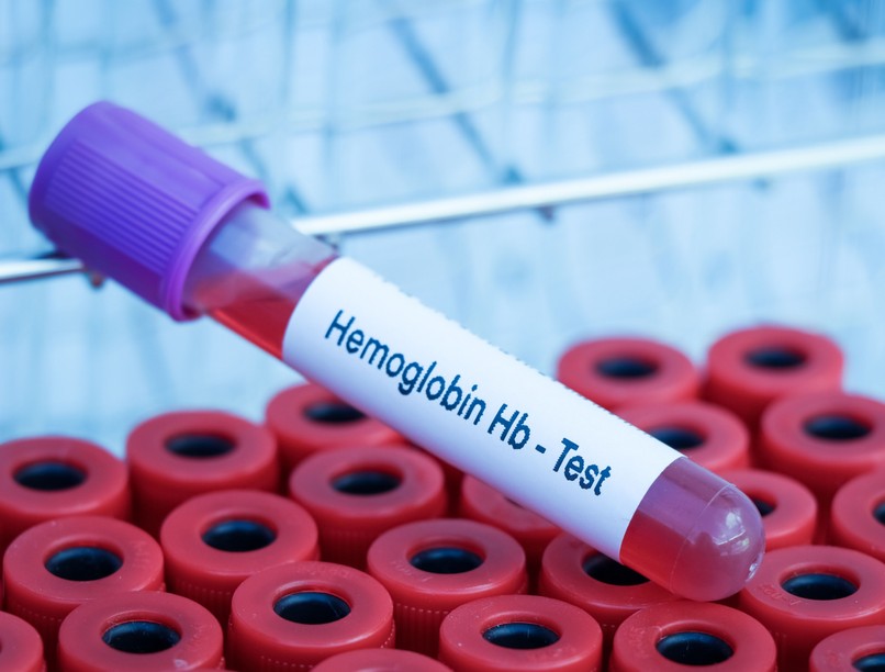 hemoglobin alacsony mikor veszélyes vérvétel vértranszfúzió