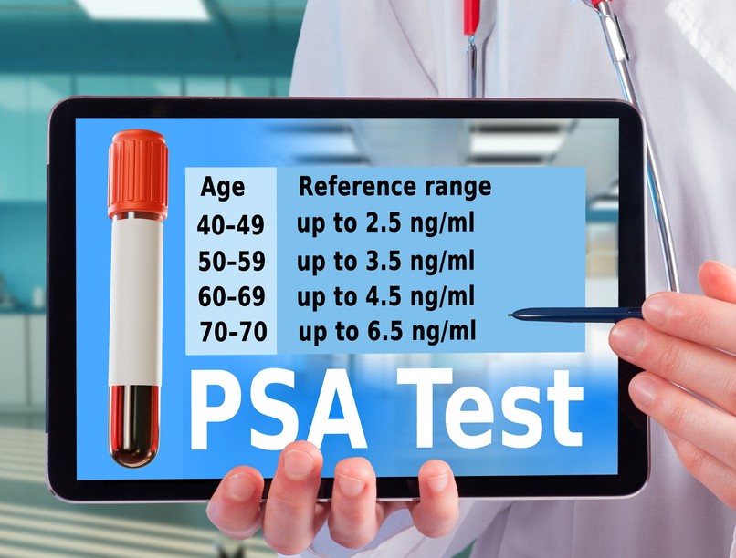 Mi a normális PSA-szint életkor szerint