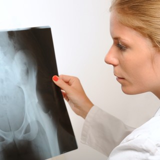 Oszteoid osztóma: tünetei, vizsgálata és kezelési lehetőségei című cikk nyitóképe