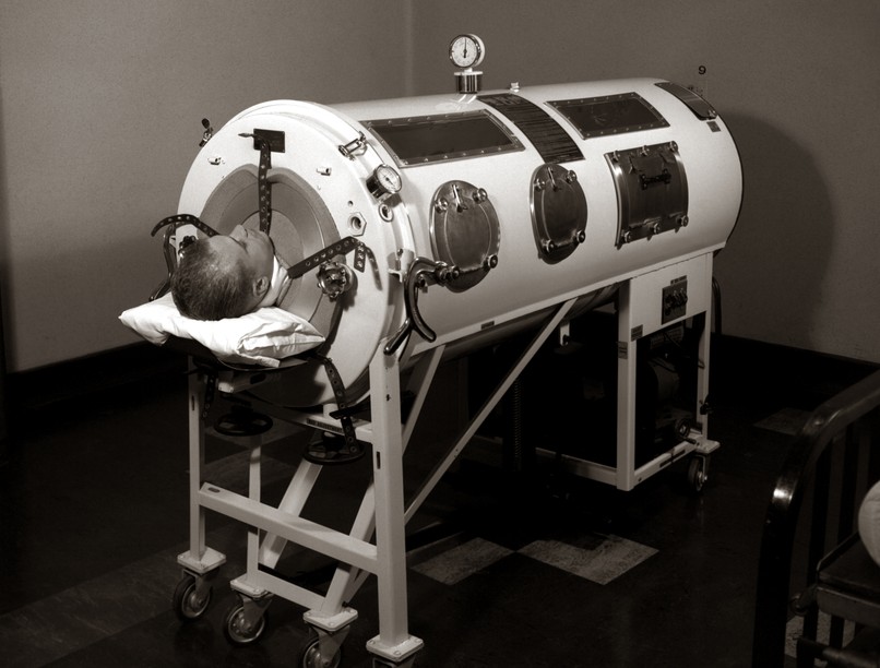 Paul Alexander, vastüdő, gyermekbénulás