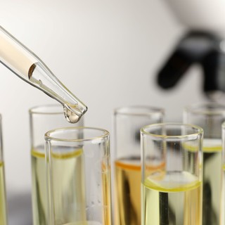 Mit jelent a víztiszta, átlátszó, szinte már színtelen vizelet? Nem mindig jó hír, ha túl tiszta című cikk nyitóképe