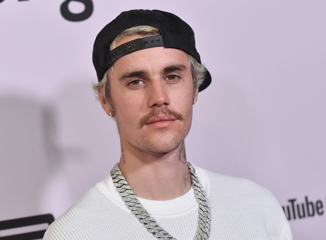 Egy vírus miatt lebénult Justin Bieber fél arca