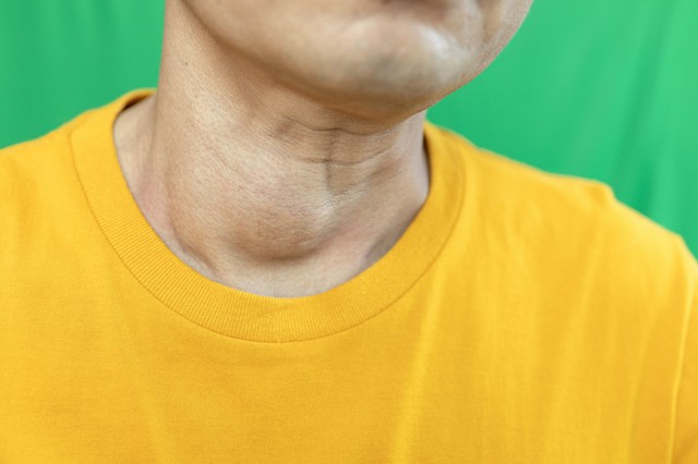 Mikor kell műteni a strúmát? Az endokrinológus válaszol