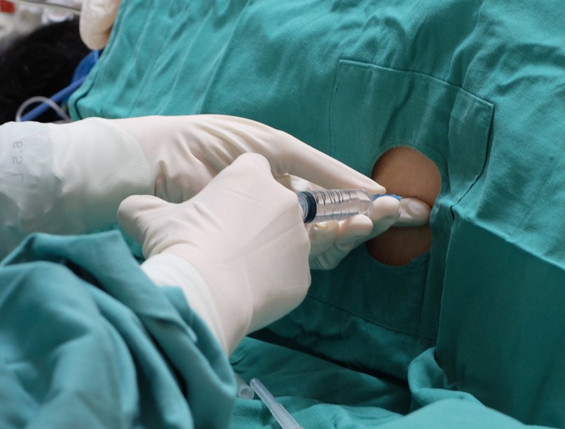 agyhártyagyulladás, meningitis, szepszis, fertőzés