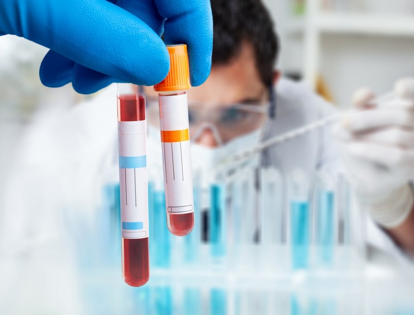 rosszindulatú daganat kiújulás áttét korai diagnózis