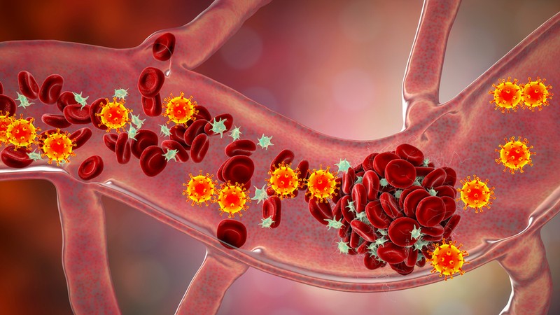 Poszt-covid: ha sokára épült fel, ezekről az apró vérrögökről tudnia kell!