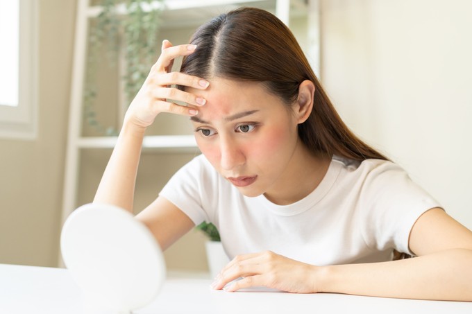 Súlyos autoimmun betegséget jelezhet az, ha így pirosodik ki az arcbőre című cikk nyitóképe