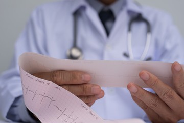 Pitvarfibrilláció: ezek a tünetek akár évekkel korábban előre jelezhetik 