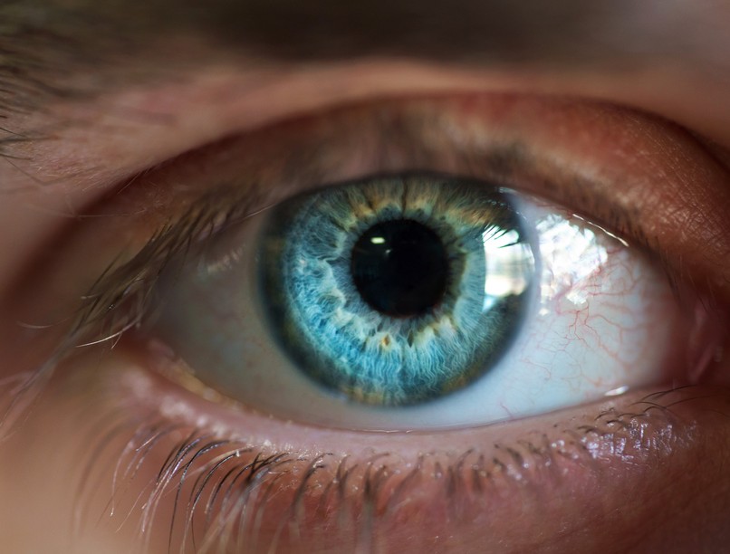 szemmozgás Alzheimer-kór hajlam tünet