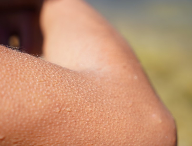 libabőr érzelem hidegrázás oka