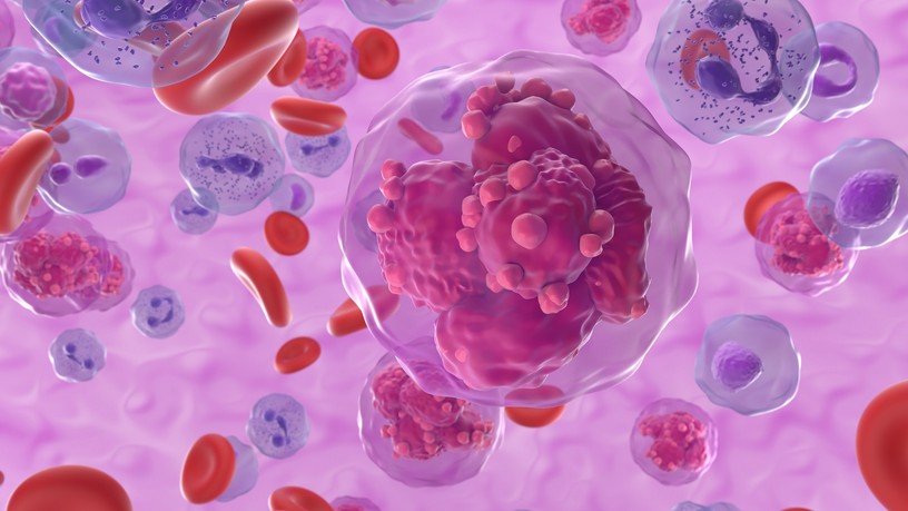 vérszegénység gyengeség fáradékonyság vérrák tumor