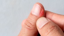 Sorjás körmök ellen: a legjobb otthoni praktikák és megelőzési tippek című cikk nyitóképe