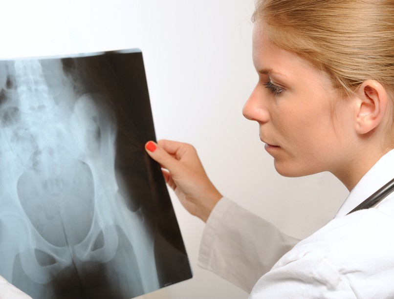 csontrák,Oszteoid osztóma