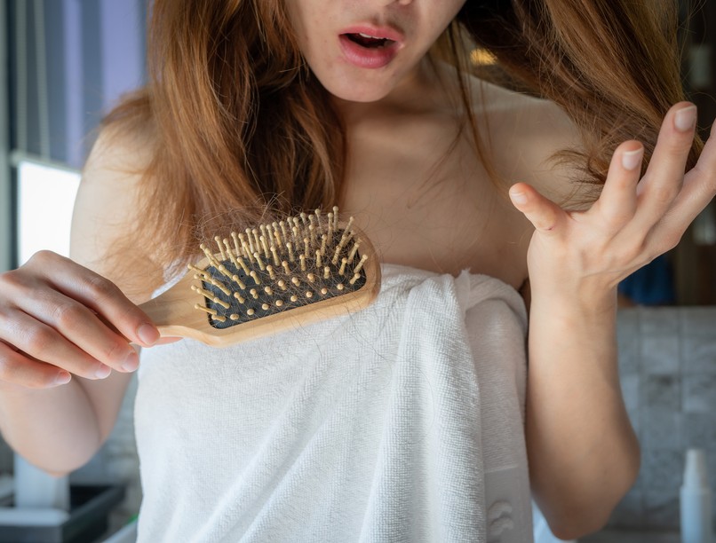 Hajhullás okai, haj, hormonális változások, szülés után, kopaszodás