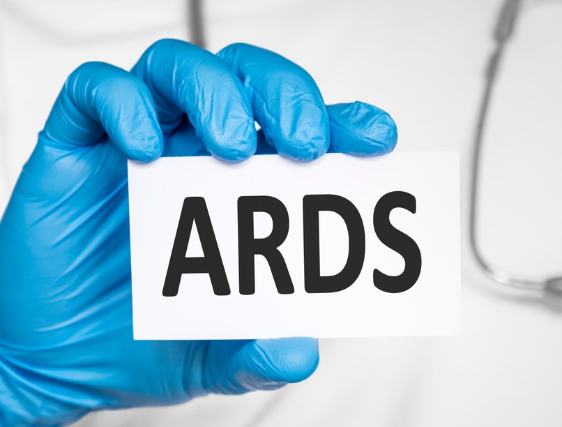 Akut légúti distressz szindróma ARDS