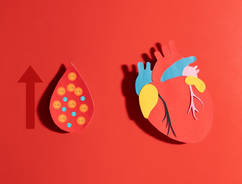 érelmeszesedés kockázat kimutatása vérből