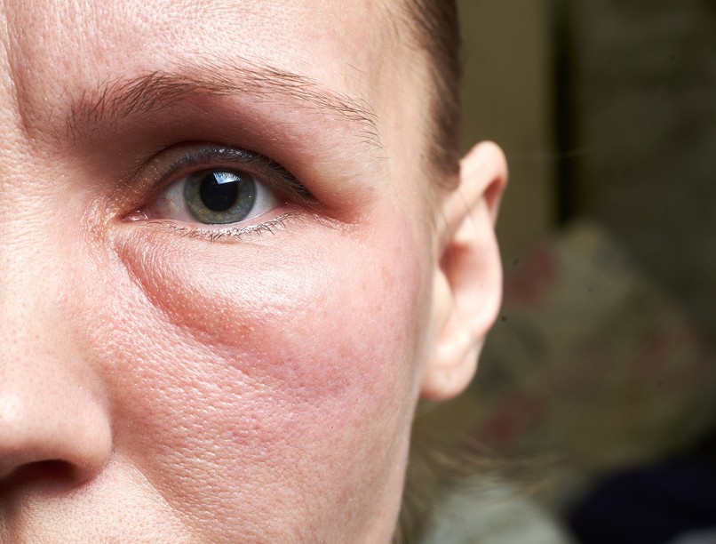 furcsa szokatlan tünet pajzsmirigyzavar oka