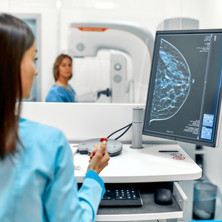 Mellrák: ezzel a vizsgálattal korán kiszűrhető a tumor című cikk nyitóképe
