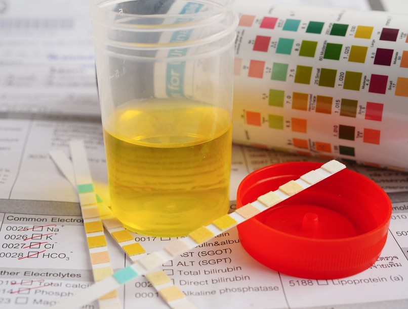 vizelet fajsúly magas mit jelent