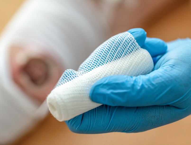 Mit jelent fekélyesedés