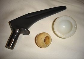 Az ortopédiai implantátumok allergiát okozhatnak!