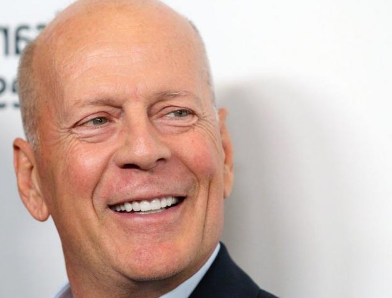 bruce willis, afázia, afázia tünetei, beszédprobléma, szósaláták