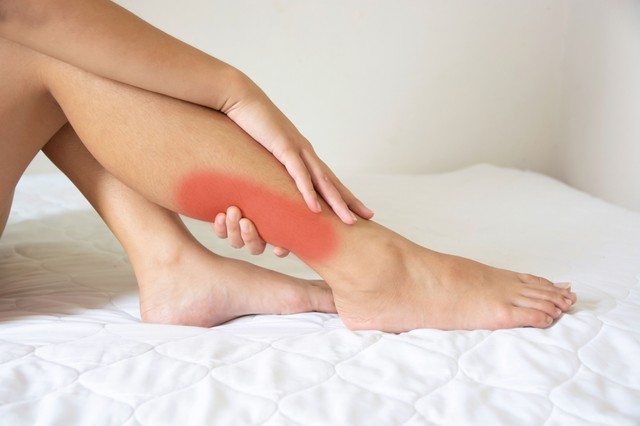 Trombózis után: ezek a legfontosabbak teendők az orvosok szerint