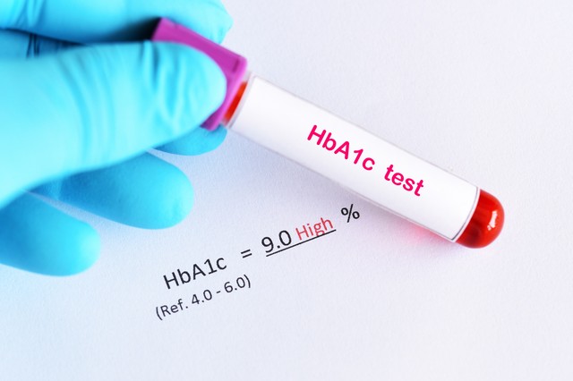 Mit jelent, ha magas a HbA1c érték a leleten?