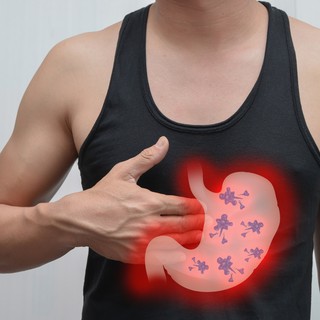 Mi a gyomor adenocarcinoma? című cikk nyitóképe