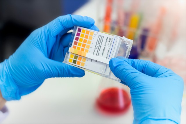 Rákbetegség: mikor jelez a véres vizelet daganatot?