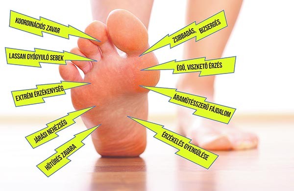 A lábfájdalom számos betegség tünete lehet