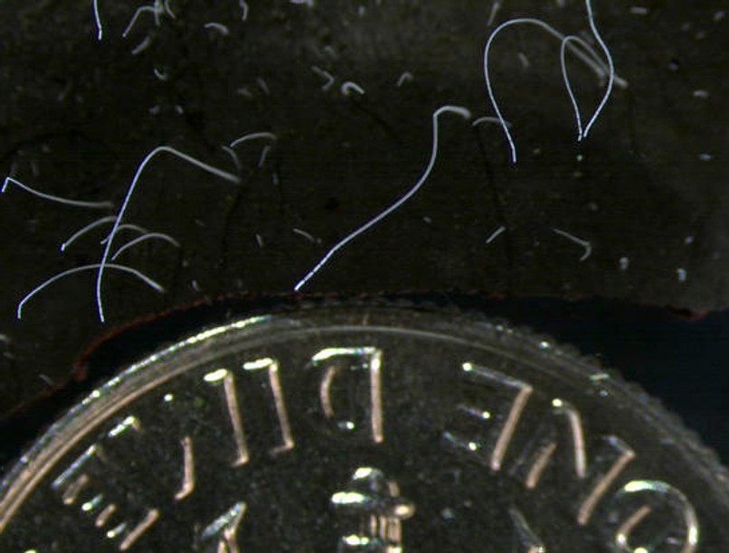 baktérium, fertőzés, kórokozó, a világ legnagyobb baktériuma