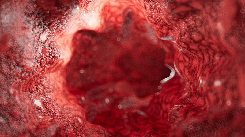 Mi a kapillaroszkópia és mit mutat ki?