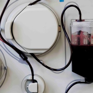 Mit jelent a plazmaferezis? című cikk nyitóképe