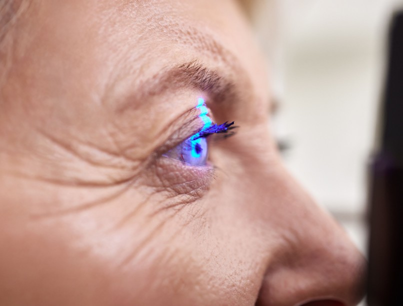 szemdaganat, szem melanóma, látás, sugárkezelés, műtét