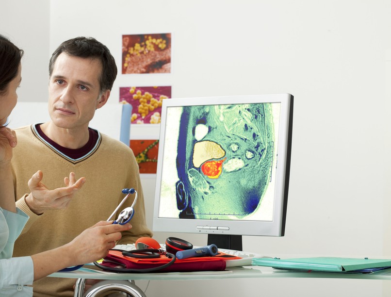 prosztata, prosztatarák, prosztata daganatok, MR, MRI-vizsgálat, biposzia