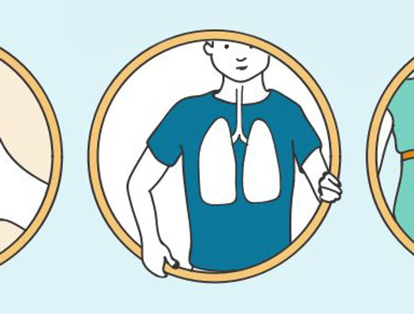 szisztemas_sclerosis_0