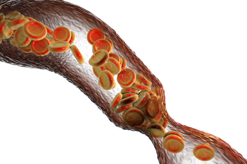 Dohányzik? Érszűkülete lehet: ellenőriztesse a lábát!