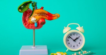  Hasnyálmirigyrák: ennyi idő alatt változhat daganattá az elváltozás 