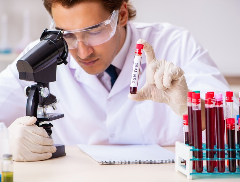 labor vizsgálat pajzsmirigy AntiTPO enzim TSH