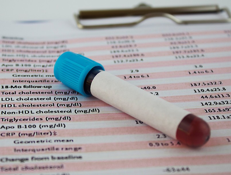 koleszterin szint mikor magas HDL LDL