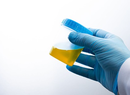 Egy vizeletminta, ami t��bbet mond a koráról, mint a személyije című cikk nyitóképe