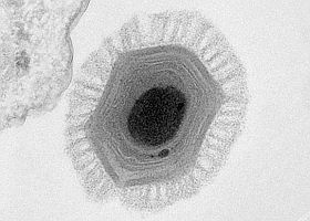 Ennél nagyobb vírus nem is lehet...