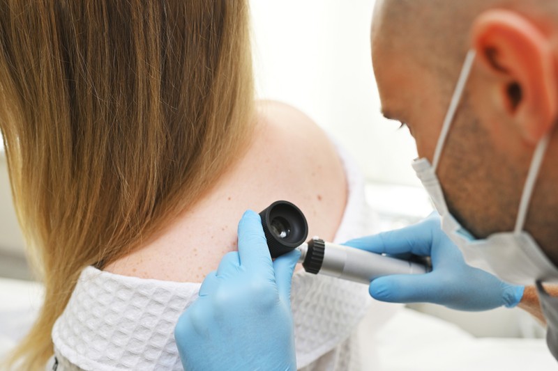 Bőrrákra utal-e az, ha vérzik az anyajegy? Ez a bőrgyógyász véleménye