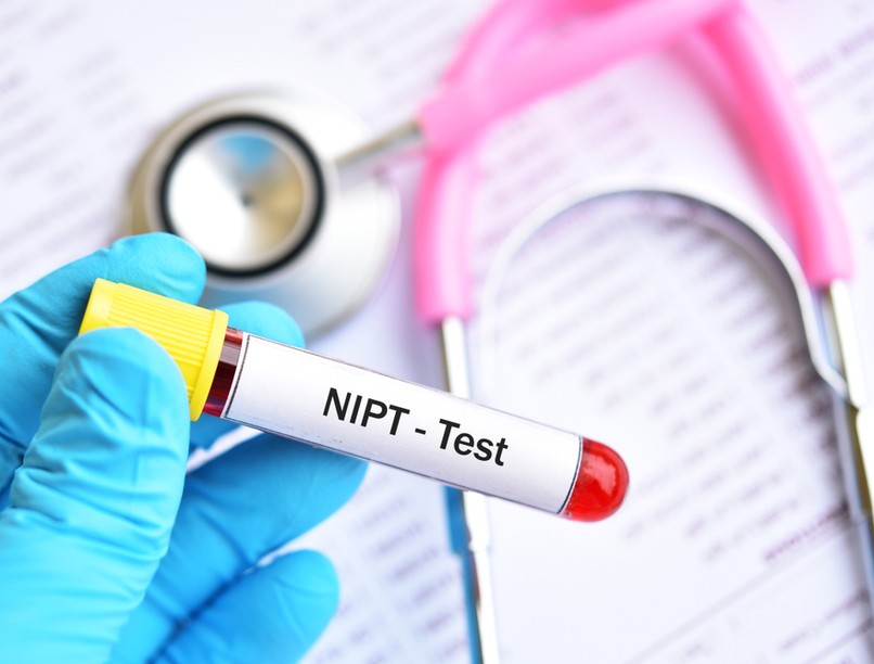 NIPT teszt, DNS-vizsgálat, genetika, magzati genetikai teszt, Down-szindróma