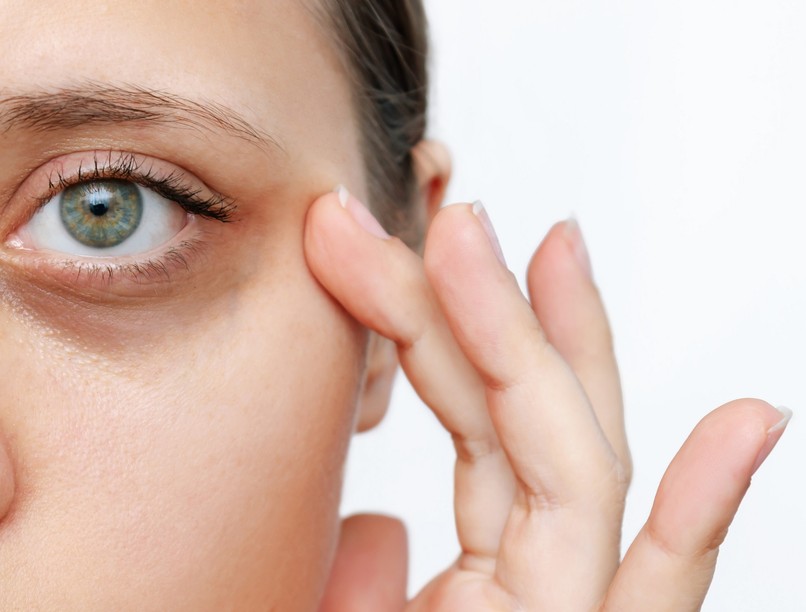 fuzzadt, fáradt, karikás szem